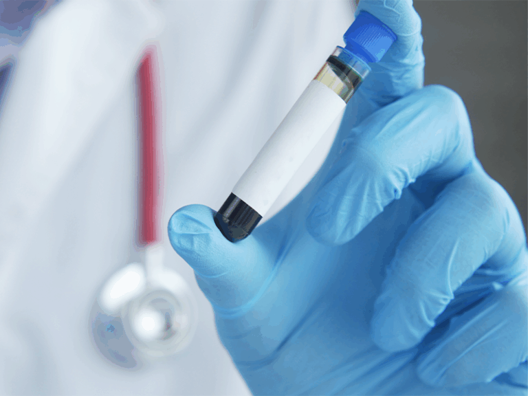 Cual es la prueba rapida de dengue lo que debes saber